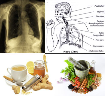 ANATUK Obat  Batuk Berdahak Paling Ampuh  Untuk  Semua 